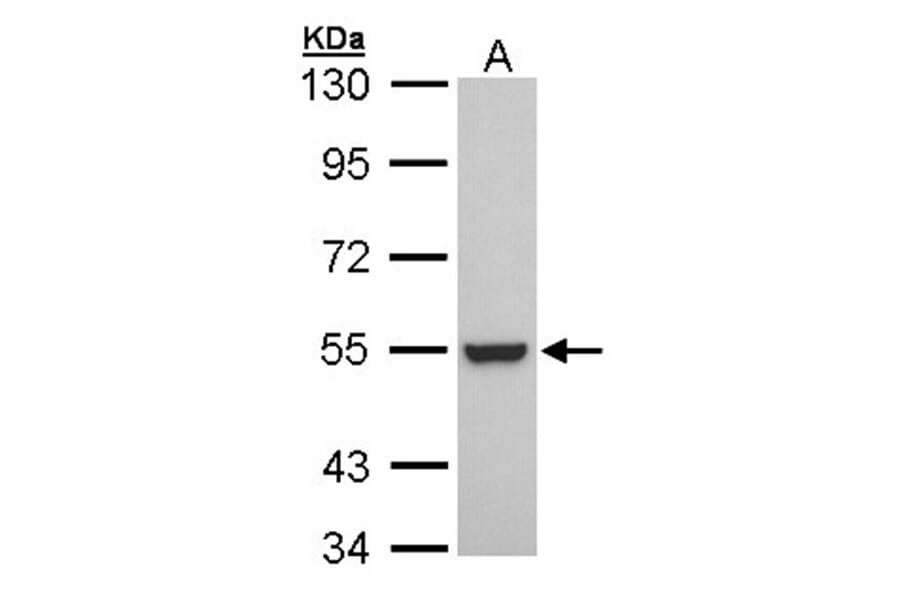 Retinoid X Receptor beta antibody from Signalway Antibody (22702) - Antibodies.com