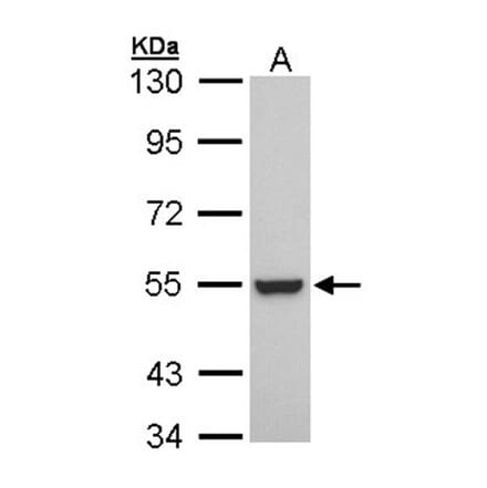 Retinoid X Receptor beta antibody from Signalway Antibody (22702) - Antibodies.com