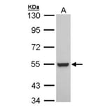 Retinoid X Receptor beta antibody from Signalway Antibody (22702) - Antibodies.com