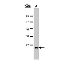 Glutathione Peroxidase 2 antibody from Signalway Antibody (22858) - Antibodies.com