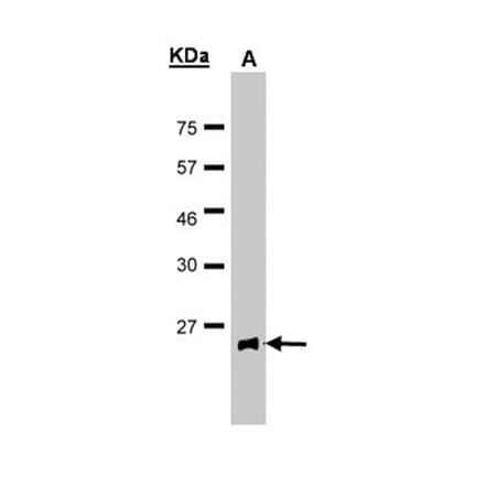 Glutathione Peroxidase 2 antibody from Signalway Antibody (22858) - Antibodies.com