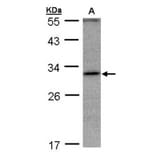 ankyrin repeat domain 45 antibody from Signalway Antibody (23181) - Antibodies.com