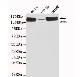SMC1A (C-term) Monoclonal Antibody from Signalway Antibody (27023) - Antibodies.com