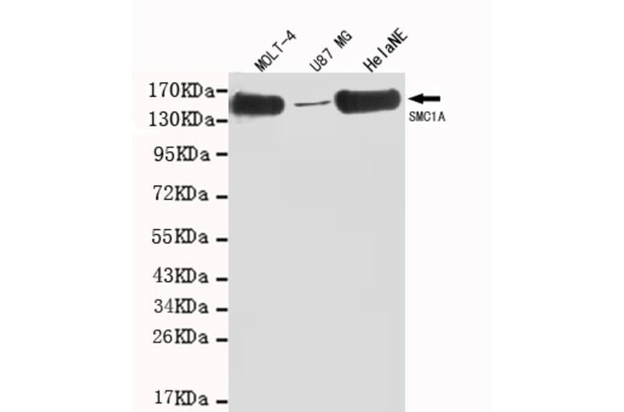 SMC1A (C-term) Monoclonal Antibody from Signalway Antibody (27023) - Antibodies.com