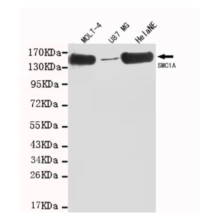 SMC1A (C-term) Monoclonal Antibody from Signalway Antibody (27023) - Antibodies.com