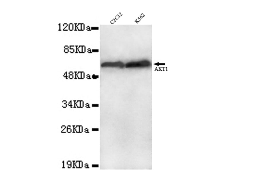 AKT1 ( C-term) Monoclonal Antibody from Signalway Antibody (27038) - Antibodies.com