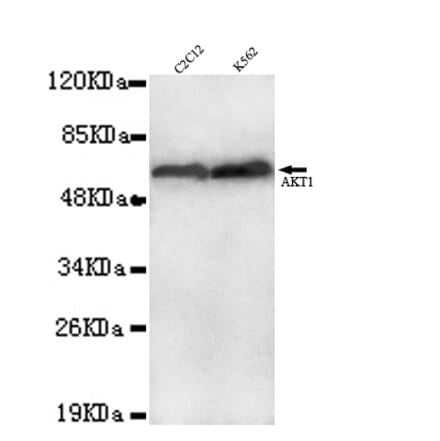 AKT1 ( C-term) Monoclonal Antibody from Signalway Antibody (27038) - Antibodies.com