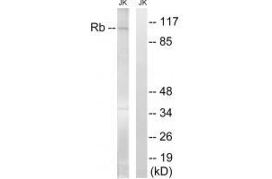 Western blot - Retinoblastoma (Ab-608) Antibody from Signalway Antibody (33220) - Antibodies.com