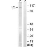 Western blot - Retinoblastoma (Ab-608) Antibody from Signalway Antibody (33220) - Antibodies.com