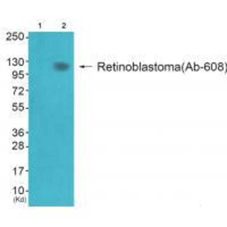 Western blot - Retinoblastoma (Ab-608) Antibody from Signalway Antibody (33220) - Antibodies.com