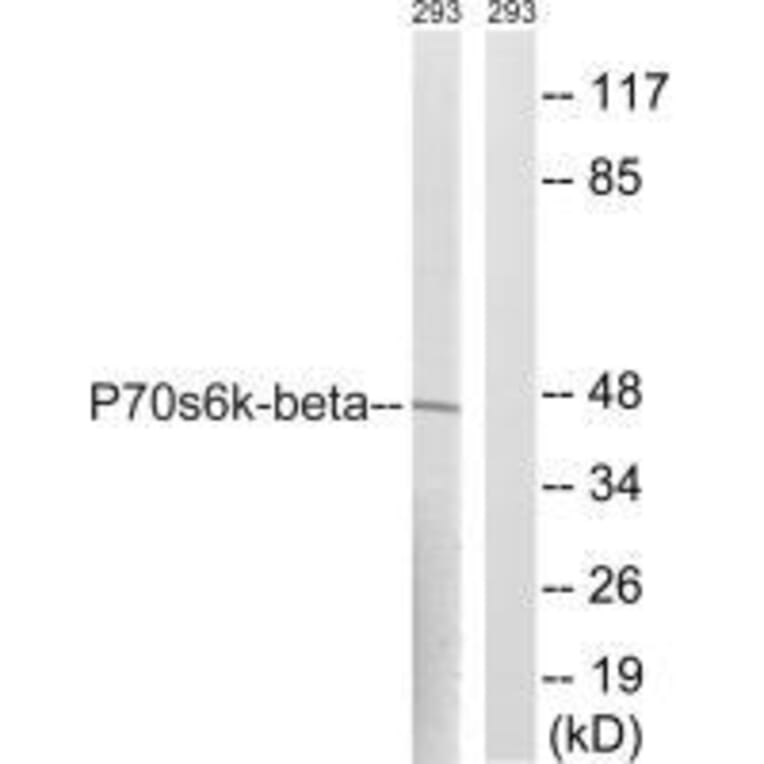 Western blot - p70 S6 Kinase β (Ab-423) Antibody from Signalway Antibody (33240) - Antibodies.com
