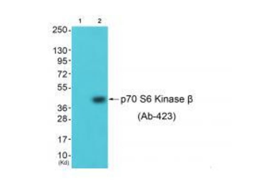 Western blot - p70 S6 Kinase β (Ab-423) Antibody from Signalway Antibody (33240) - Antibodies.com