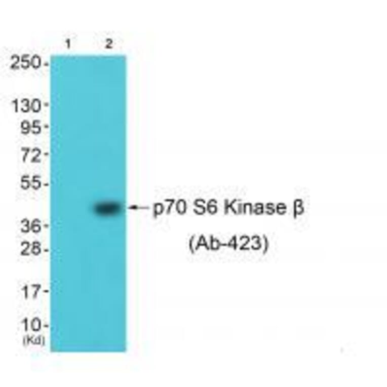 Western blot - p70 S6 Kinase β (Ab-423) Antibody from Signalway Antibody (33240) - Antibodies.com