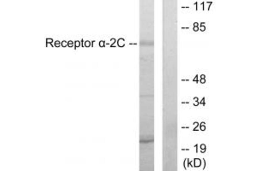 Western blot - Adrenergic Receptor α-2C Antibody from Signalway Antibody (33702) - Antibodies.com