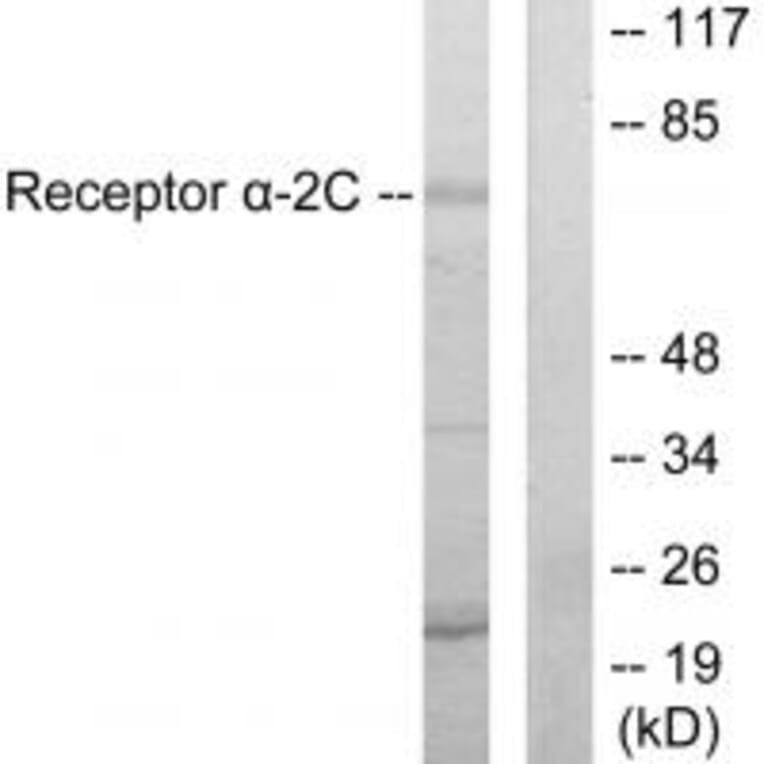 Western blot - Adrenergic Receptor α-2C Antibody from Signalway Antibody (33702) - Antibodies.com