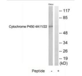 Western blot - Cytochrome P450 4A11/22 Antibody from Signalway Antibody (35260) - Antibodies.com