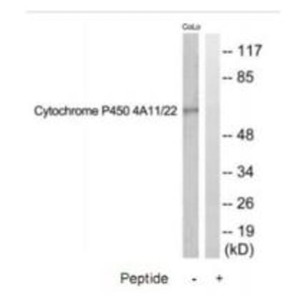 Western blot - Cytochrome P450 4A11/22 Antibody from Signalway Antibody (35260) - Antibodies.com