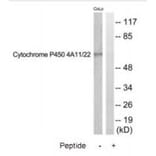 Western blot - Cytochrome P450 4A11/22 Antibody from Signalway Antibody (35260) - Antibodies.com
