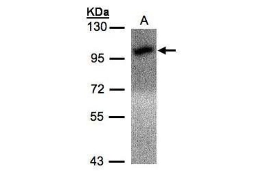 Calcium Sensing Receptor Antibody from Signalway Antibody (35338) - Antibodies.com
