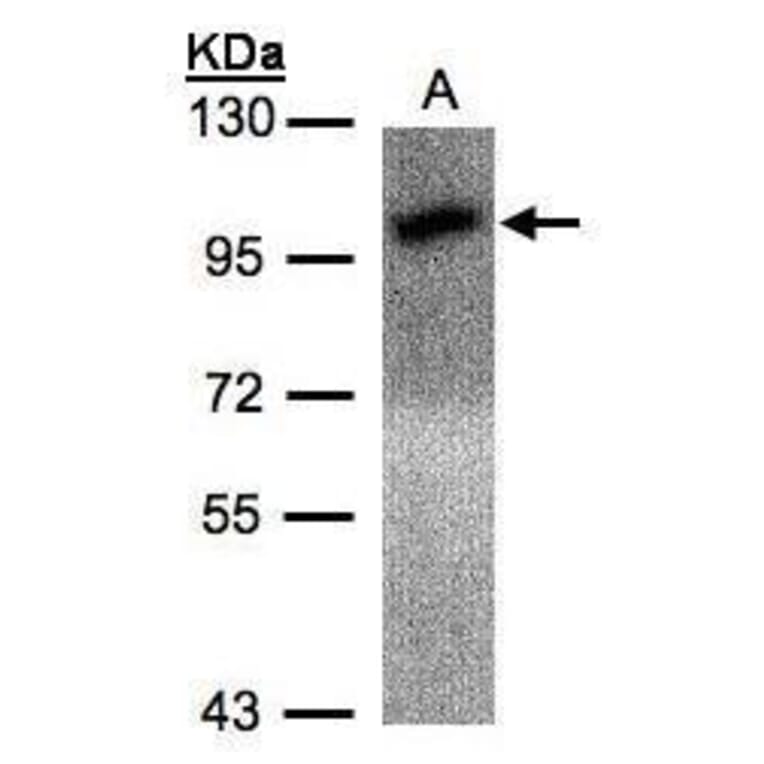 Calcium Sensing Receptor Antibody from Signalway Antibody (35338) - Antibodies.com