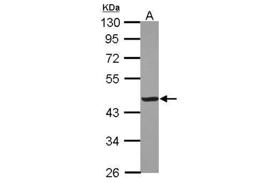 Creatine kinase (muscle) Antibody from Signalway Antibody (35413) - Antibodies.com