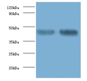 Alpha-enolase Polyclonal Antibody from Signalway Antibody (42159) - Antibodies.com