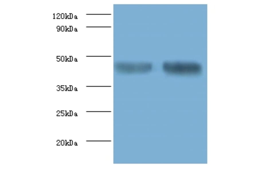 Alpha-enolase Polyclonal Antibody from Signalway Antibody (42159) - Antibodies.com
