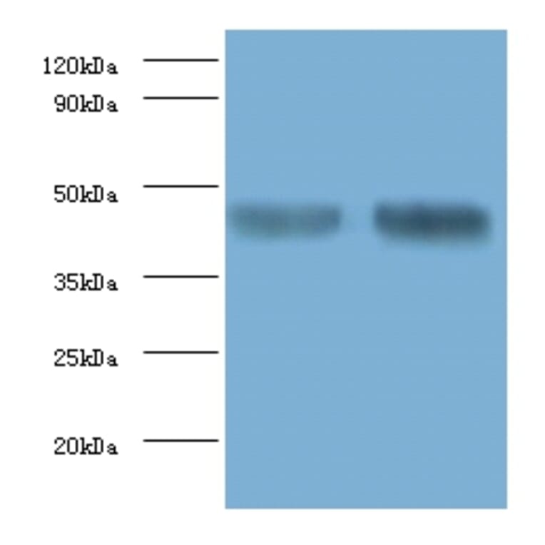 Alpha-enolase Polyclonal Antibody from Signalway Antibody (42159) - Antibodies.com