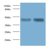 Alpha-enolase Polyclonal Antibody from Signalway Antibody (42159) - Antibodies.com