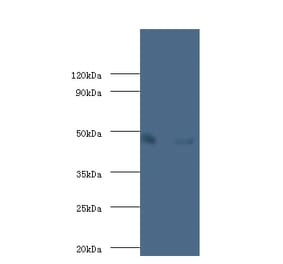 Alpha-enolase Polyclonal Antibody from Signalway Antibody (42349) - Antibodies.com