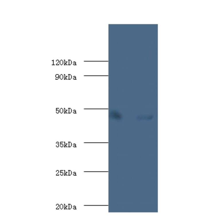 Alpha-enolase Polyclonal Antibody from Signalway Antibody (42349) - Antibodies.com