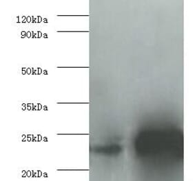 Interleukin-6 Polyclonal Antibody from Signalway Antibody (42464) - Antibodies.com