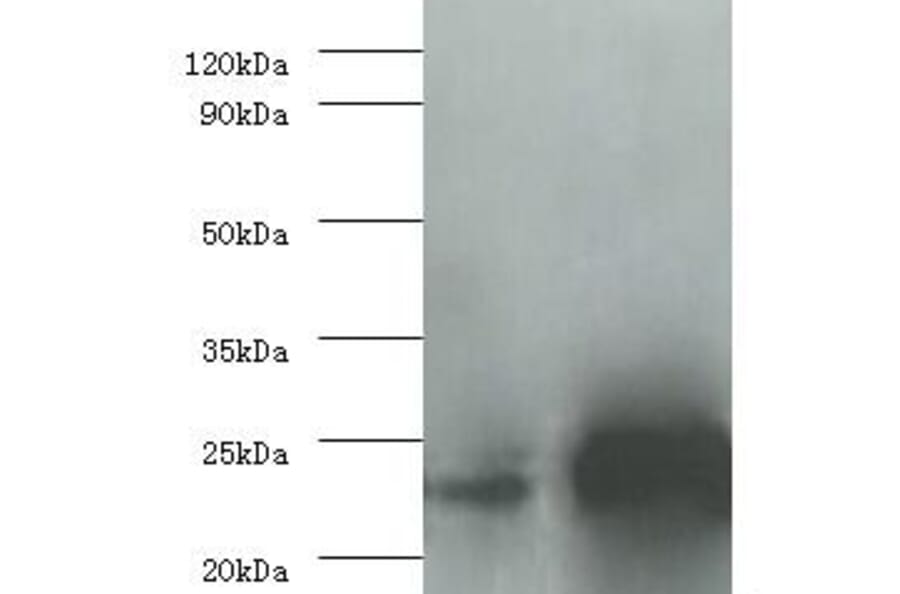 Interleukin-6 Polyclonal Antibody from Signalway Antibody (42464) - Antibodies.com