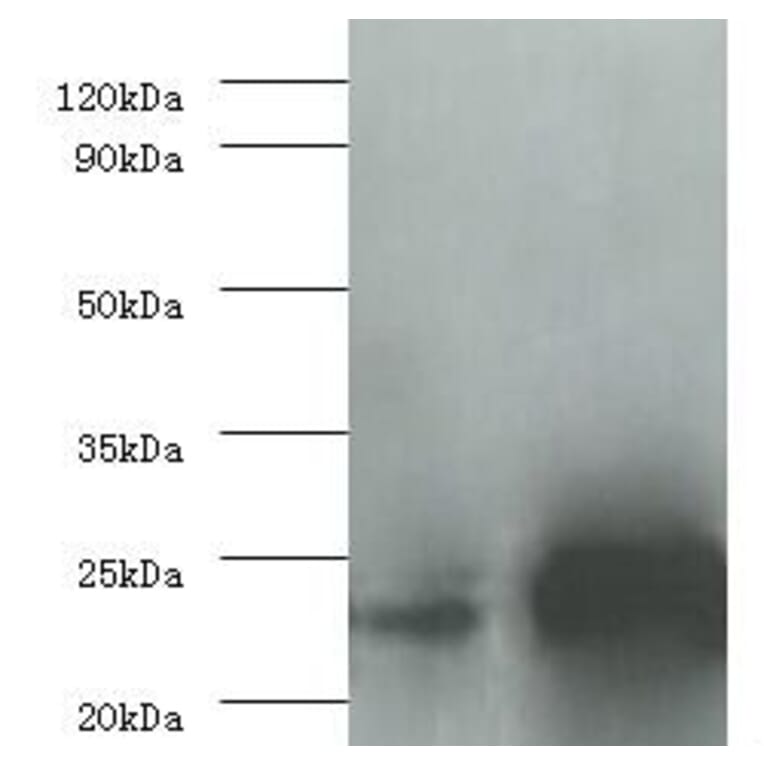 Interleukin-6 Polyclonal Antibody from Signalway Antibody (42464) - Antibodies.com