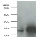 Interleukin-6 Polyclonal Antibody from Signalway Antibody (42464) - Antibodies.com