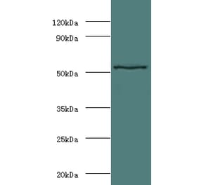 Stromelysin-1 Polyclonal Antibody from Signalway Antibody (42486) - Antibodies.com