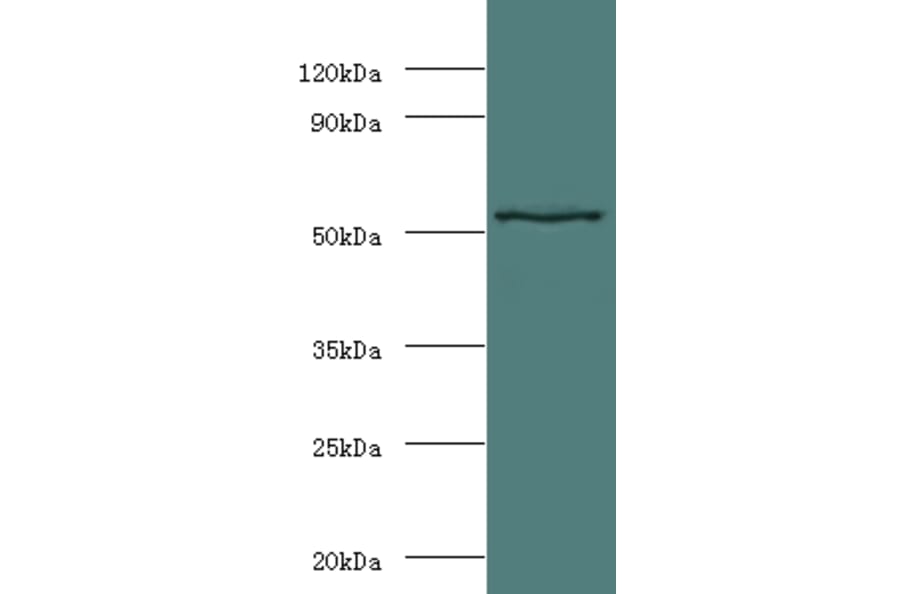 Stromelysin-1 Polyclonal Antibody from Signalway Antibody (42486) - Antibodies.com
