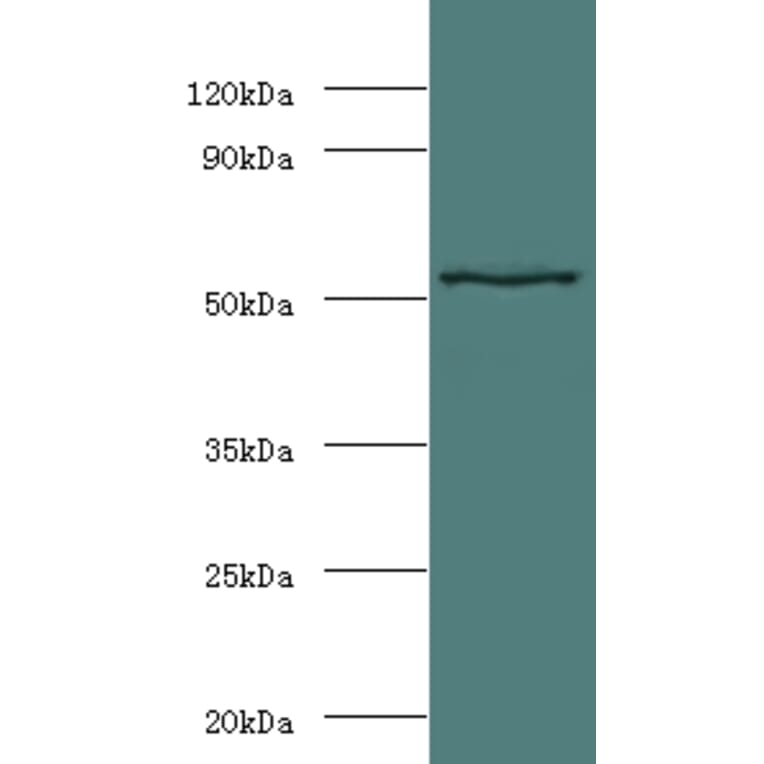 Stromelysin-1 Polyclonal Antibody from Signalway Antibody (42486) - Antibodies.com