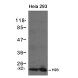 Western blot - H2B Antibody from Signalway Antibody (21417) - Antibodies.com