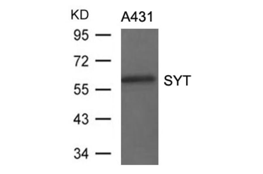 Western blot - SYT Antibody from Signalway Antibody (21438) - Antibodies.com
