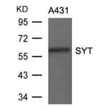 Western blot - SYT Antibody from Signalway Antibody (21438) - Antibodies.com