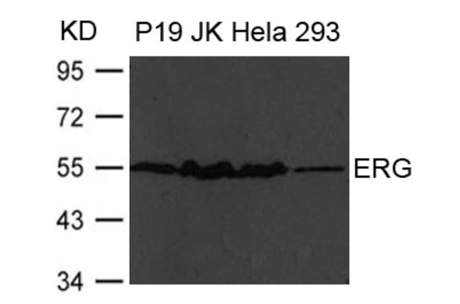 Western blot - ERG Antibody from Signalway Antibody (21480) - Antibodies.com