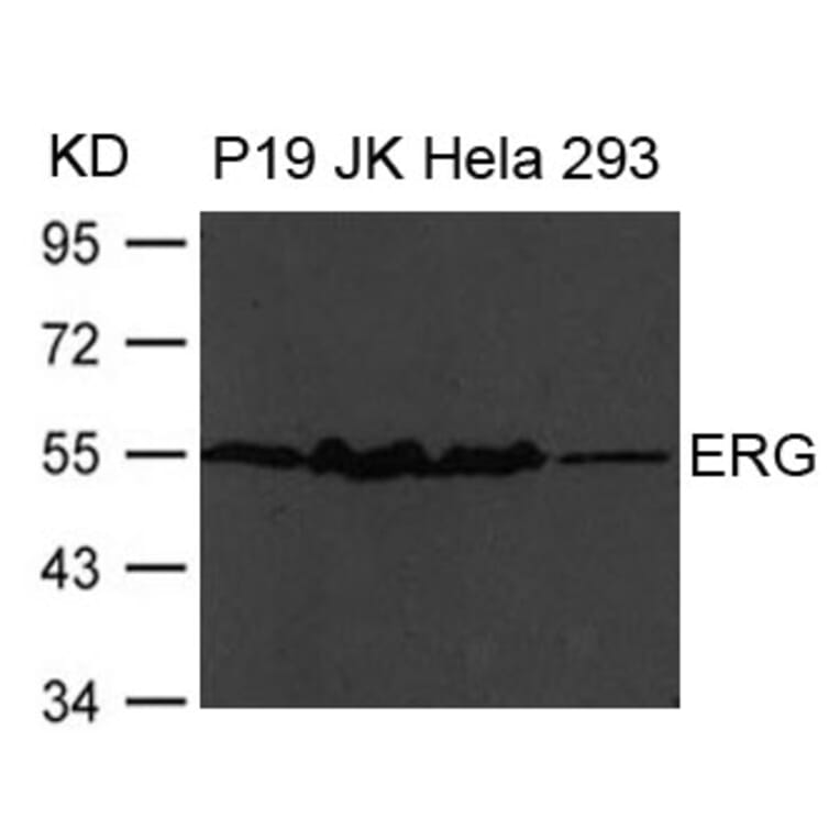 Western blot - ERG Antibody from Signalway Antibody (21480) - Antibodies.com