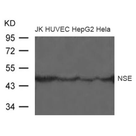 Western blot - NSE Antibody from Signalway Antibody (21487) - Antibodies.com