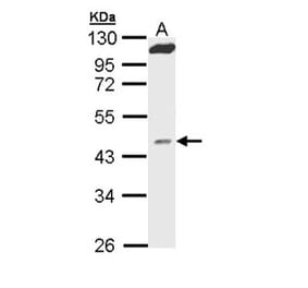 MVD antibody from Signalway Antibody (22260) - Antibodies.com