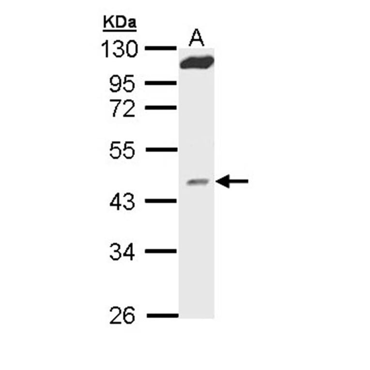 MVD antibody from Signalway Antibody (22260) - Antibodies.com