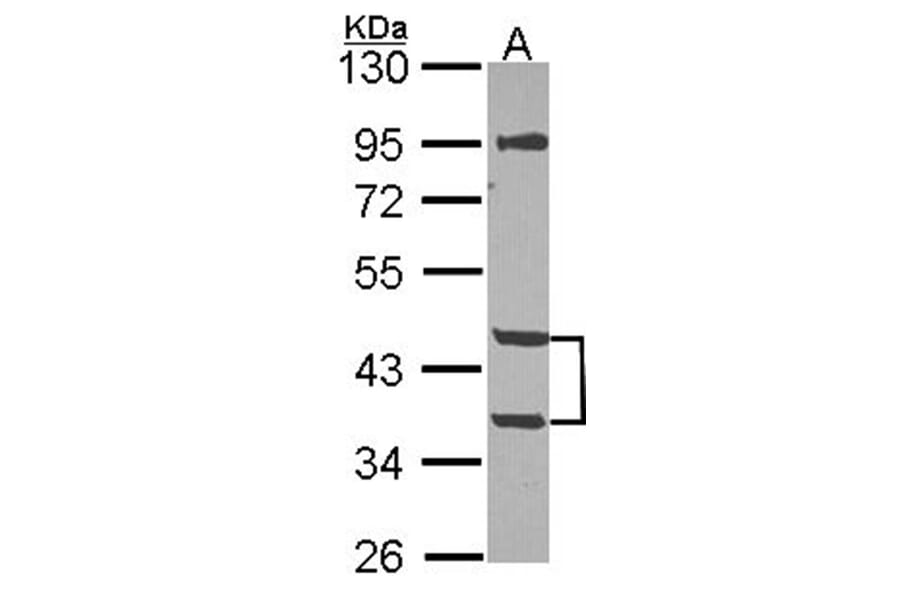 MPI antibody from Signalway Antibody (22328) - Antibodies.com