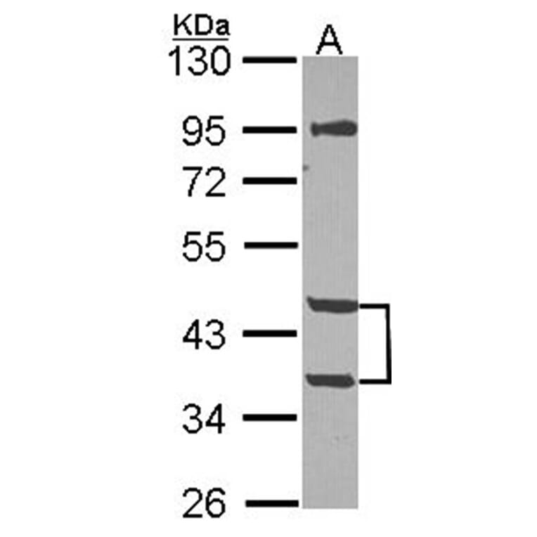MPI antibody from Signalway Antibody (22328) - Antibodies.com