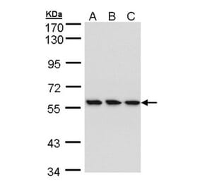 HCE antibody from Signalway Antibody (22405) - Antibodies.com