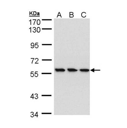 HCE antibody from Signalway Antibody (22405) - Antibodies.com